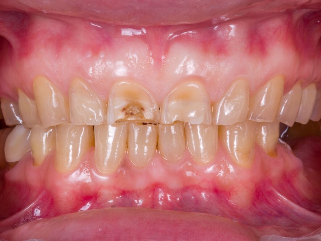 Estetica dentale — prima