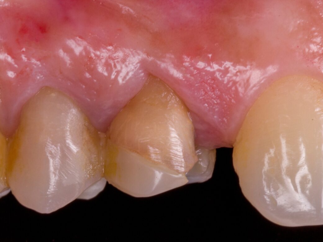 Estetica dentale — prima