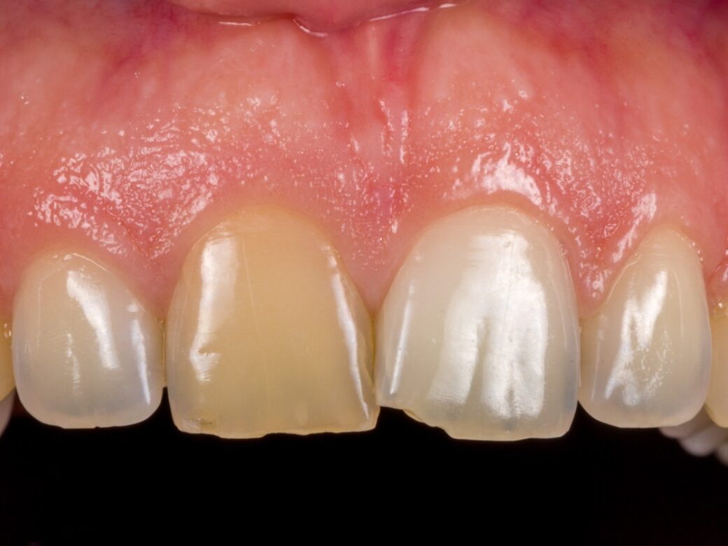 Estetica dentale — prima