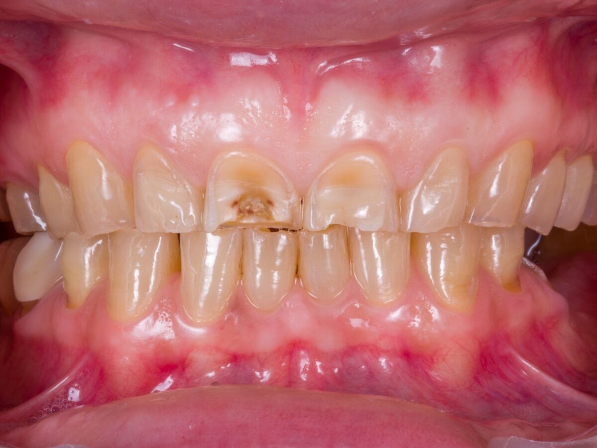 Riabilitazione completa fase 1 — diagnosi