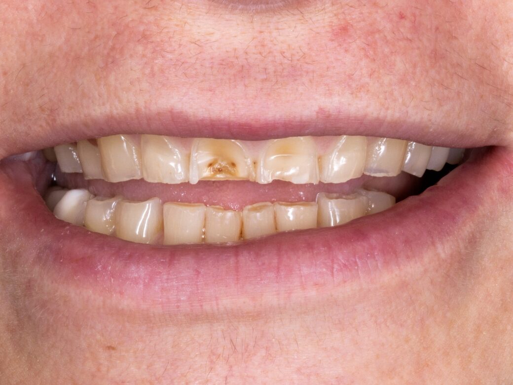 Estetica dentale — prima