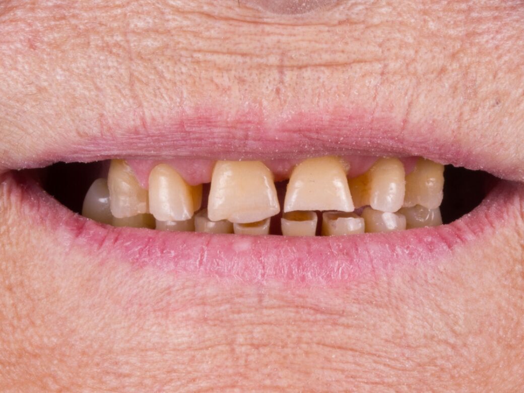 Estetica dentale — prima