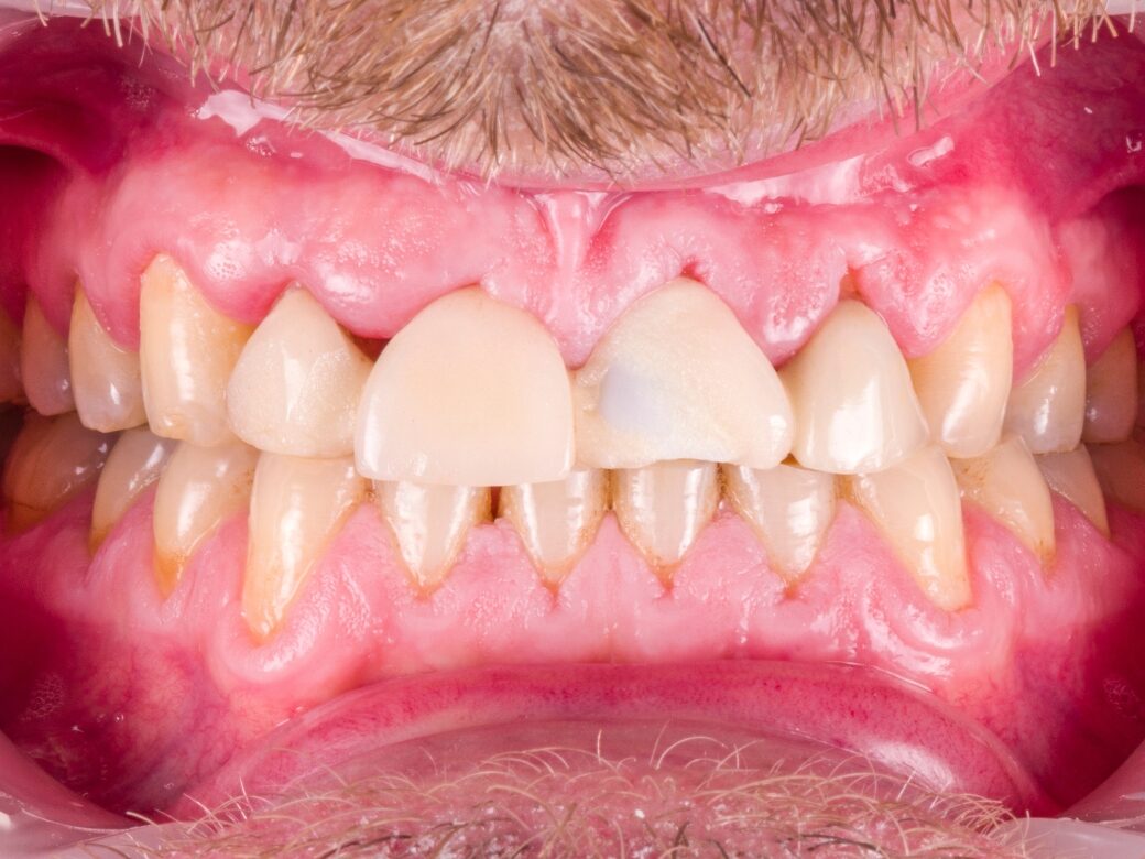 Estetica dentale — prima