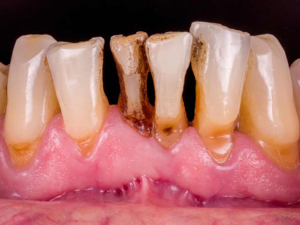 Estetica dentale — prima